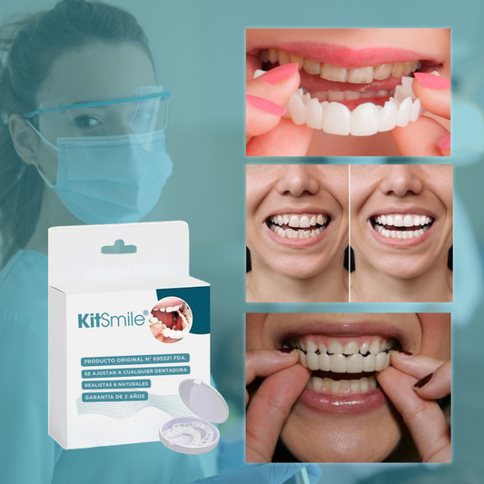 KitSmile® - Carillas Dentales (Kit Completo)