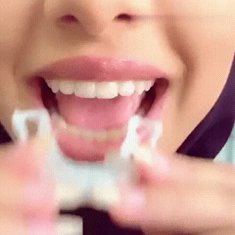 KitSmile® - Carillas Dentales (Kit Completo) – Mayorista ARG